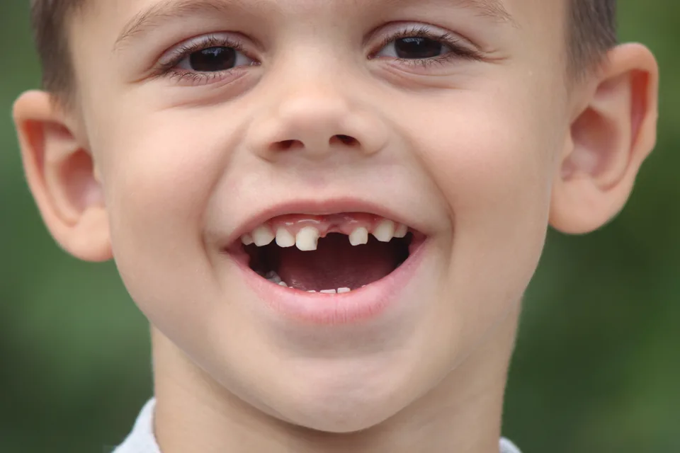 A laughing boy with a front tooth missing